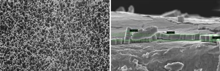 铝打黑细节图 铝打黑细节图